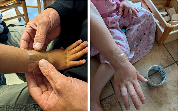 teacher sticking sellotape to child's wrist